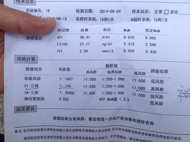 唐氏筛查检查报告单