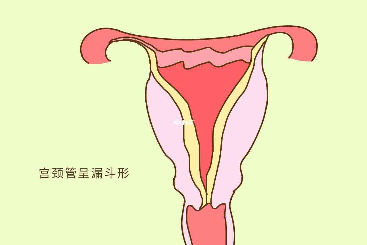 三、正常子宫及附件的声像图表现-超声诊断-医学