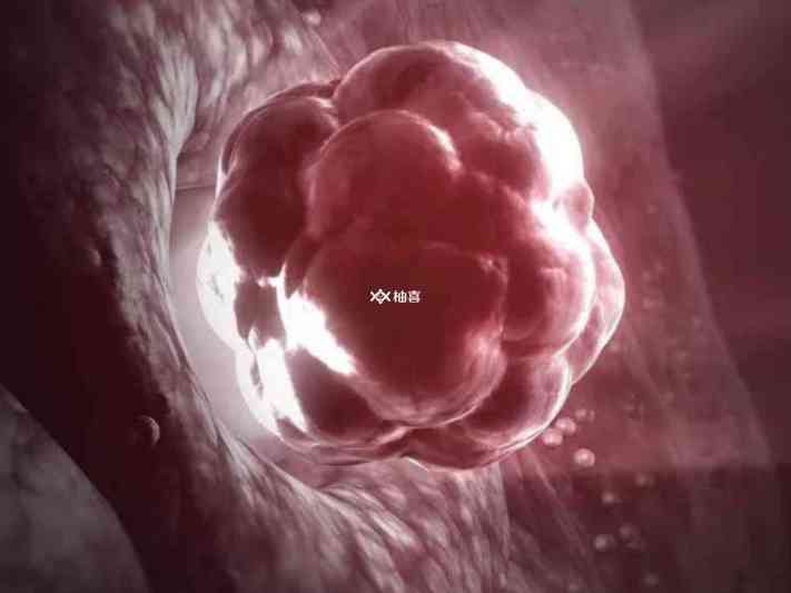 单卵双胎主要分四种类型