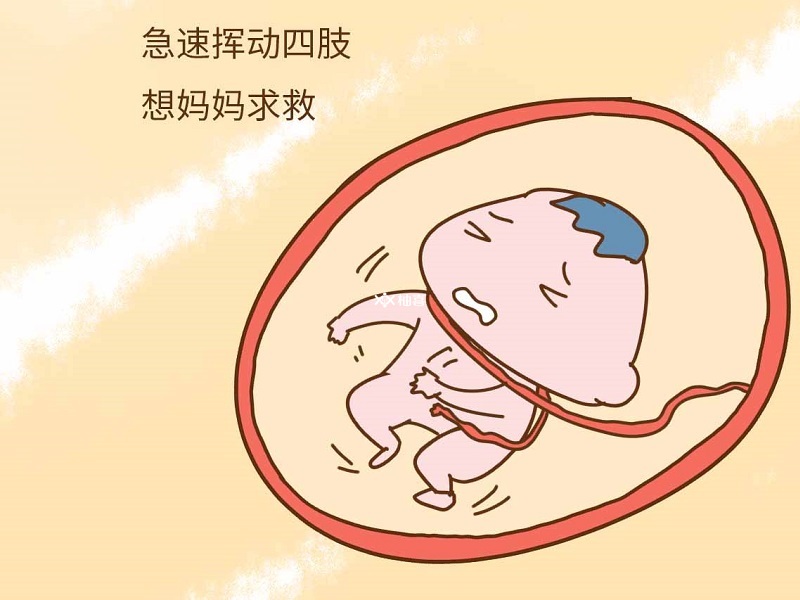 胎动剧烈可能是宝宝在求救