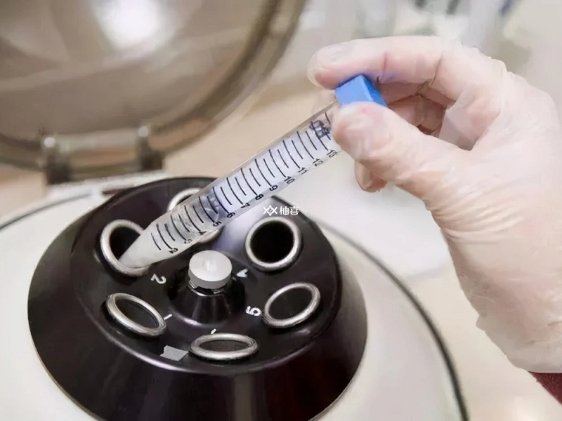 试管医生说的洗精就是对优选精子的精液处理技术