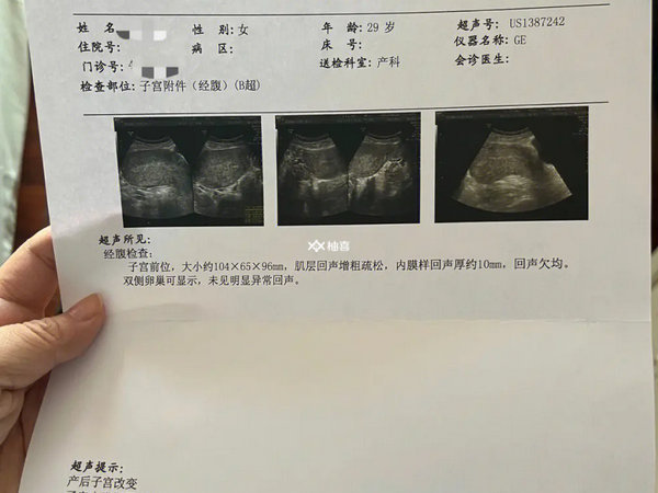 怀二胎