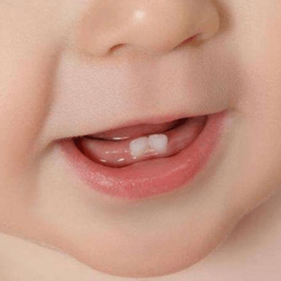 婴儿出牙早期图片图片