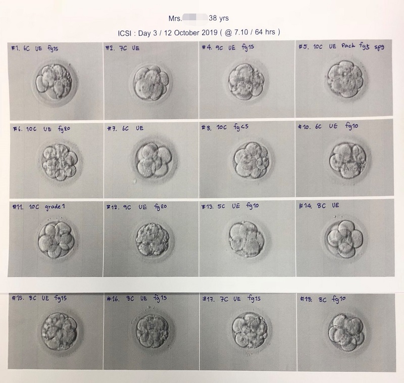 胚胎级别成功率图图片